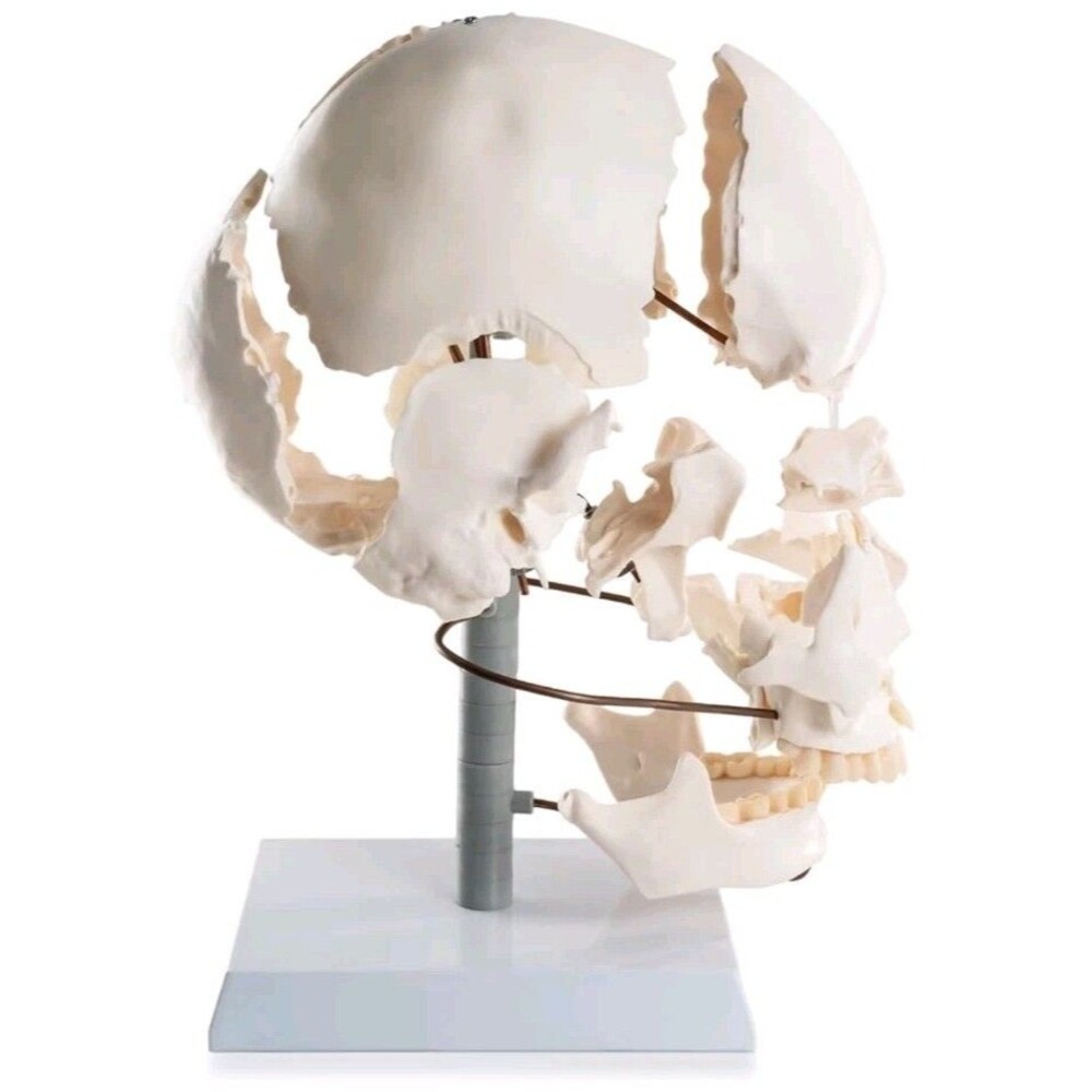 22-Piece Exploded Human Skull Model, Full Size, Bone Color Disassembled Cranial - Picture 5 of 12